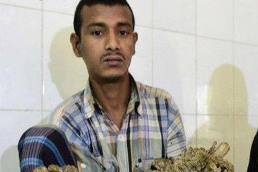 A man in India has a strange disease and the branches are covered with branches. His wife abandoned him after giving birth to two children!_Picture 1